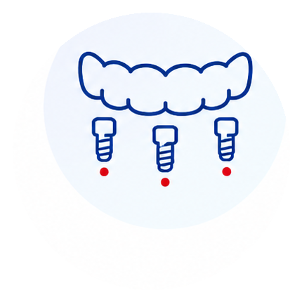 All on 4 dental implant arch icon