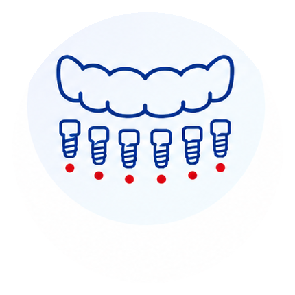 All on 6 dental implant arch icon